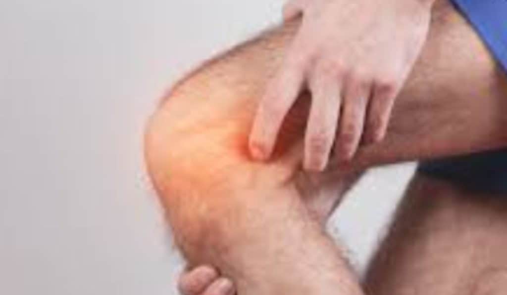 slijmbeursontsteking