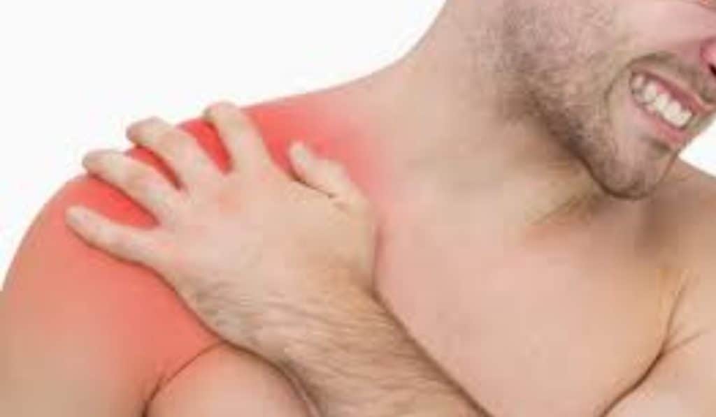 Schouderpijn door slijmbeursontsteking symptomen oorzaken en oefeningen