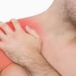 Schouderpijn door slijmbeursontsteking symptomen oorzaken en oefeningen